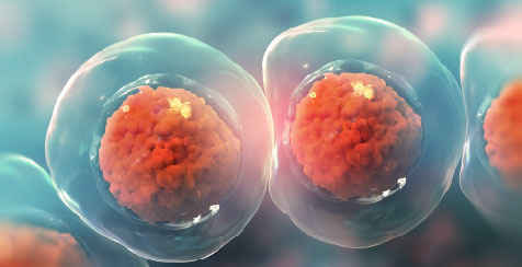 Acoustothermal Transfection for Cell Therapy